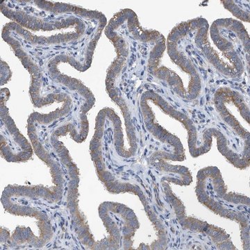 Anti-PPM1M antibody produced in rabbit Prestige Antibodies&#174; Powered by Atlas Antibodies, affinity isolated antibody, buffered aqueous glycerol solution