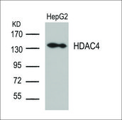 Anti-HDAC4 (Ab-632) antibody produced in rabbit affinity isolated antibody