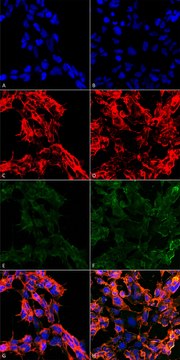 Monoclonal Anti-7-Ketocholesterol antibody produced in mouse clone 3F7