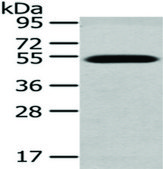 Anti-TCN2 affinity isolated antibody