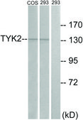 Anti-TYK2 antibody produced in rabbit affinity isolated antibody