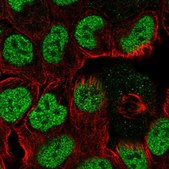 Anti-TPRG1 antibody produced in rabbit Prestige Antibodies® Powered by Atlas Antibodies, affinity isolated antibody, buffered aqueous glycerol solution