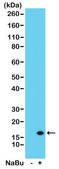 Anti-Acetyl-Histone H3 (Lys14) antibody, Rabbit monoclonal recombinant, expressed in HEK 293 cells, clone RM130, purified immunoglobulin