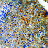 Anti-phospho-Cortactin (pTyr466) antibody produced in rabbit affinity isolated antibody