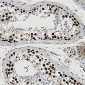 Anti-SMARCAD1 antibody produced in rabbit Prestige Antibodies® Powered by Atlas Antibodies, affinity isolated antibody, buffered aqueous glycerol solution