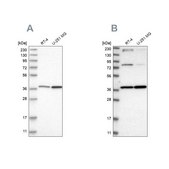 Anti-MECR antibody produced in rabbit Prestige Antibodies® Powered by Atlas Antibodies, affinity isolated antibody, buffered aqueous glycerol solution