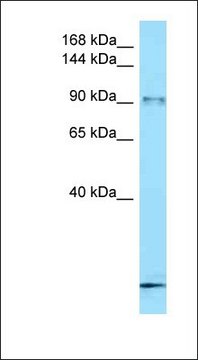 Anti-FBXO11 antibody produced in rabbit affinity isolated antibody