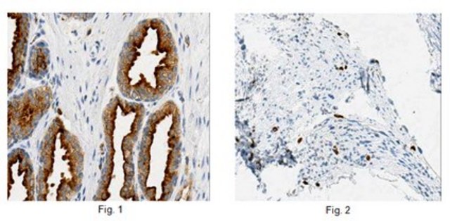 Anti-Rab27B, clone 6C10.1 Antibody clone 6C10.1, from mouse