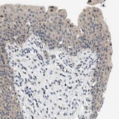 Anti-OLIG3 antibody produced in rabbit Prestige Antibodies® Powered by Atlas Antibodies, affinity isolated antibody, buffered aqueous glycerol solution