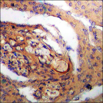 Anti-phospho-Bax (pSer184) antibody produced in rabbit affinity isolated antibody