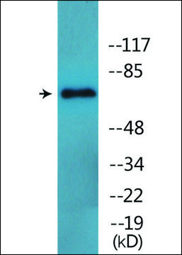 Anti-phospho-Nonvoltage-gated Sodium Channel 1 (pThr615) antibody produced in rabbit affinity isolated antibody