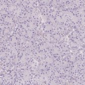 Anti-SH3GL2 antibody produced in rabbit Prestige Antibodies® Powered by Atlas Antibodies, affinity isolated antibody, buffered aqueous glycerol solution