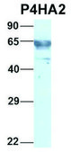 Anti-P4HA2 (C-terminal) antibody produced in rabbit affinity isolated antibody