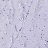 Anti-LZTFL1 antibody produced in rabbit Prestige Antibodies® Powered by Atlas Antibodies, affinity isolated antibody, buffered aqueous glycerol solution