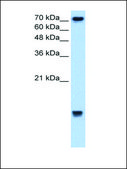 Anti-UBE2N (AB2) antibody produced in rabbit IgG fraction of antiserum