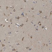 Anti-ZDHHC17 antibody produced in rabbit Prestige Antibodies® Powered by Atlas Antibodies, affinity isolated antibody, buffered aqueous glycerol solution