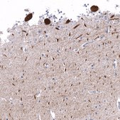 Monoclonal Anti-CALB1 antibody produced in mouse Prestige Antibodies® Powered by Atlas Antibodies, clone CL15065, purified antibody (Protein A)