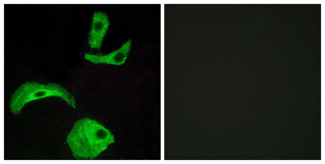 Anti-GPR18 antibody produced in rabbit affinity isolated antibody