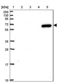 Anti-ZNF555 antibody produced in rabbit Prestige Antibodies® Powered by Atlas Antibodies, affinity isolated antibody, buffered aqueous glycerol solution
