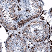 Anti-ME3 antibody produced in rabbit Prestige Antibodies® Powered by Atlas Antibodies, affinity isolated antibody, buffered aqueous glycerol solution