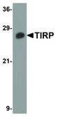 Anti-TIRP (ab1) antibody produced in rabbit affinity isolated antibody, buffered aqueous solution