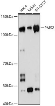 Anti-PMS2 Antibody, clone 4E5F1, Rabbit Monoclonal