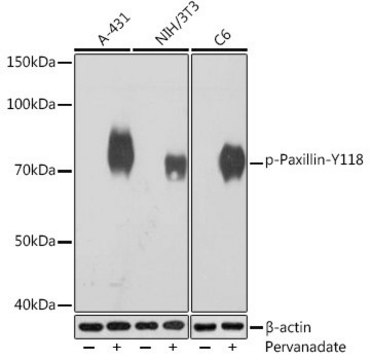 Anti-Phospho-Paxillin-Y118 antibody produced in rabbit