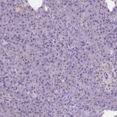 Anti-CSPG5 antibody produced in rabbit Prestige Antibodies® Powered by Atlas Antibodies, affinity isolated antibody, buffered aqueous glycerol solution