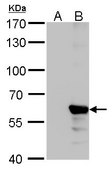 Monoclonal Anti-Influenza B Virus NP antibody produced in mouse clone GT382, affinity isolated antibody