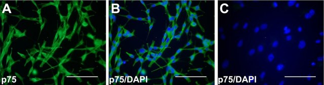 Anti-Nerve Growth Factor Receptor Antibody, extracellular, clone 192-IgG clone 192-IgG, Chemicon&#174;, from mouse