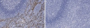 Anti-Cytokeratin 5/6 Antibody, clone D5/16 B4 ZooMAb® Mouse Monoclonal recombinant, expressed in HEK 293 cells