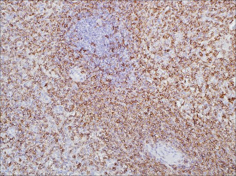 CD11c (EP157) Rabbit Monoclonal Primary Antibody