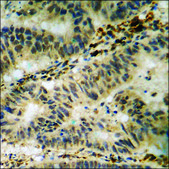 Anti-phospho-Tau (pThr181) antibody produced in rabbit affinity isolated antibody