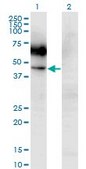Monoclonal Anti-CSF2RA antibody produced in mouse clone 2G5, purified immunoglobulin, buffered aqueous solution