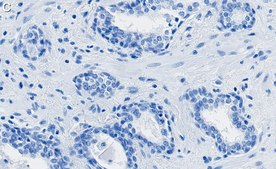 Anti-AKT1 Antibody, clone 4K6 ZooMAb® Rabbit Monoclonal recombinant, expressed in HEK 293 cells