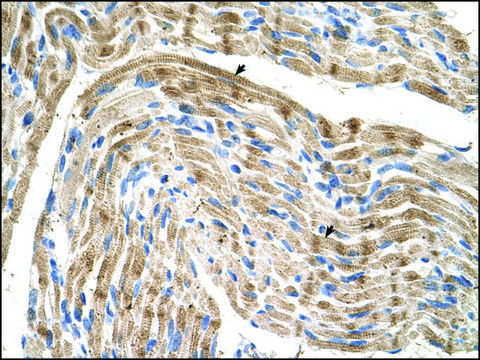 Anti-FADS1 antibody produced in rabbit IgG fraction of antiserum