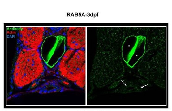 Anti-RAB5A antibody produced in rabbit affinity isolated antibody