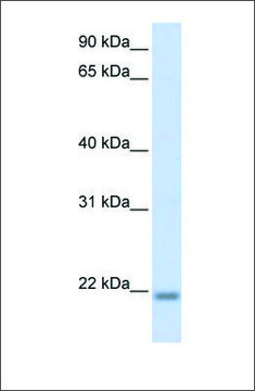 Anti-CNBP antibody produced in rabbit affinity isolated antibody