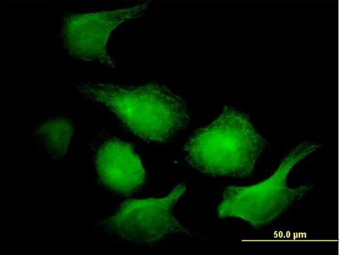 ANTI-AK1 antibody produced in mouse clone 3G8-1B11, purified immunoglobulin, buffered aqueous solution