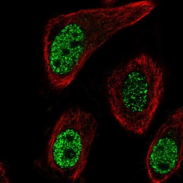 Anti-MGLL antibody produced in rabbit Prestige Antibodies&#174; Powered by Atlas Antibodies, affinity isolated antibody