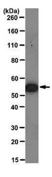 Anti-Vimentin Antibody, clone 3CB2 clone 3CB2, from mouse