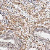 Anti-CAAP1 antibody produced in rabbit Prestige Antibodies® Powered by Atlas Antibodies, affinity isolated antibody, buffered aqueous glycerol solution, Ab3