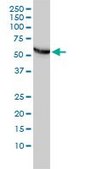 Monoclonal Anti-CCT5 antibody produced in mouse clone 4E5-4B1, purified immunoglobulin, buffered aqueous solution