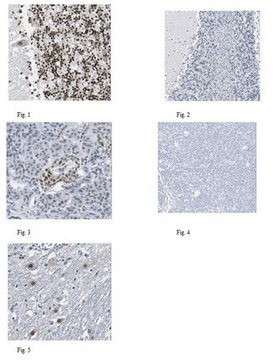 Anti-TDP-43 Antibody, clone DB9 clone DB9, from mouse