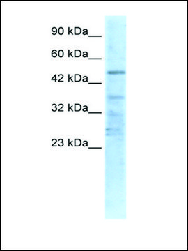 Anti-CHRNA1 (AB1) antibody produced in rabbit affinity isolated antibody