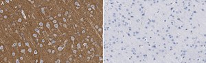 Anti-Tenascin-R Antibody, clone 23-14