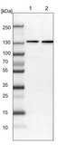 Anti-ERC1 antibody produced in rabbit Prestige Antibodies® Powered by Atlas Antibodies, affinity isolated antibody, buffered aqueous glycerol solution, Ab3