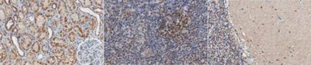 Anti-LMO-2 (Rhombotin-2) Antibody, clone 1A9-3B11 clone 1A9-3B11, from mouse