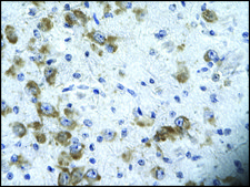 Anti-CIC IgG fraction of antiserum