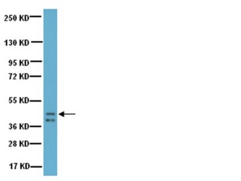 Anti-Growth Associated Protein-43 (GAP-43) Antibody Chemicon&#174;, from rabbit